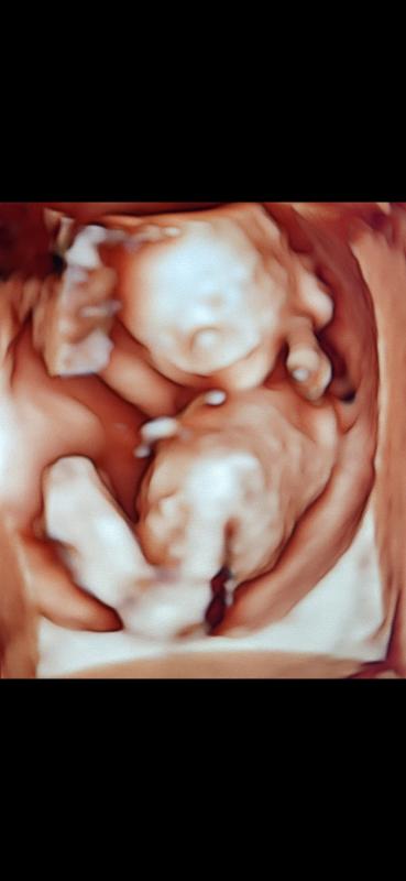 Little Miss or Little Mr 3D + 4D HD live (Gender Reveal and Wellbeing)